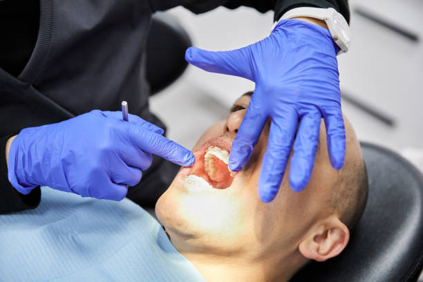 Best Emergency Treatment for Dental Infections or Abscesses in Johnson, AR