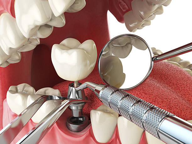 Best Cosmetic Emergency Dentistry in Johnson, AR